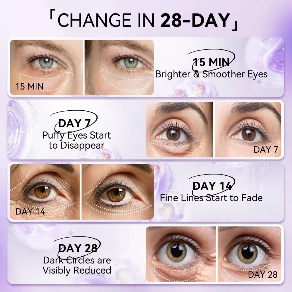 LANBENA Retinol Anti-Falten-Au – Microneedle Patch Eye Bewertung und Preis