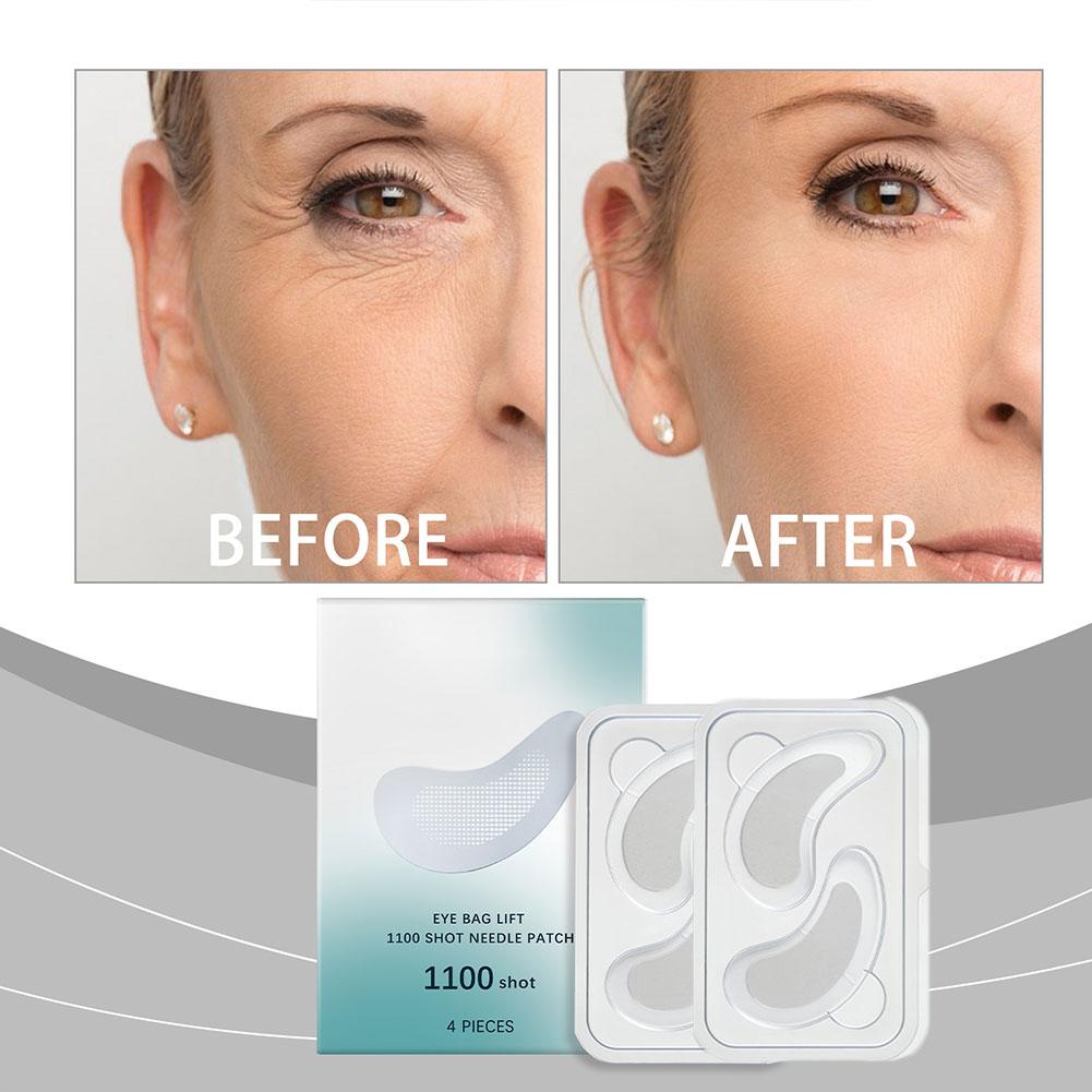 Hyaluronsäure Mikronadel Augen – Microneedle Patch Eye Bewertung und Preis