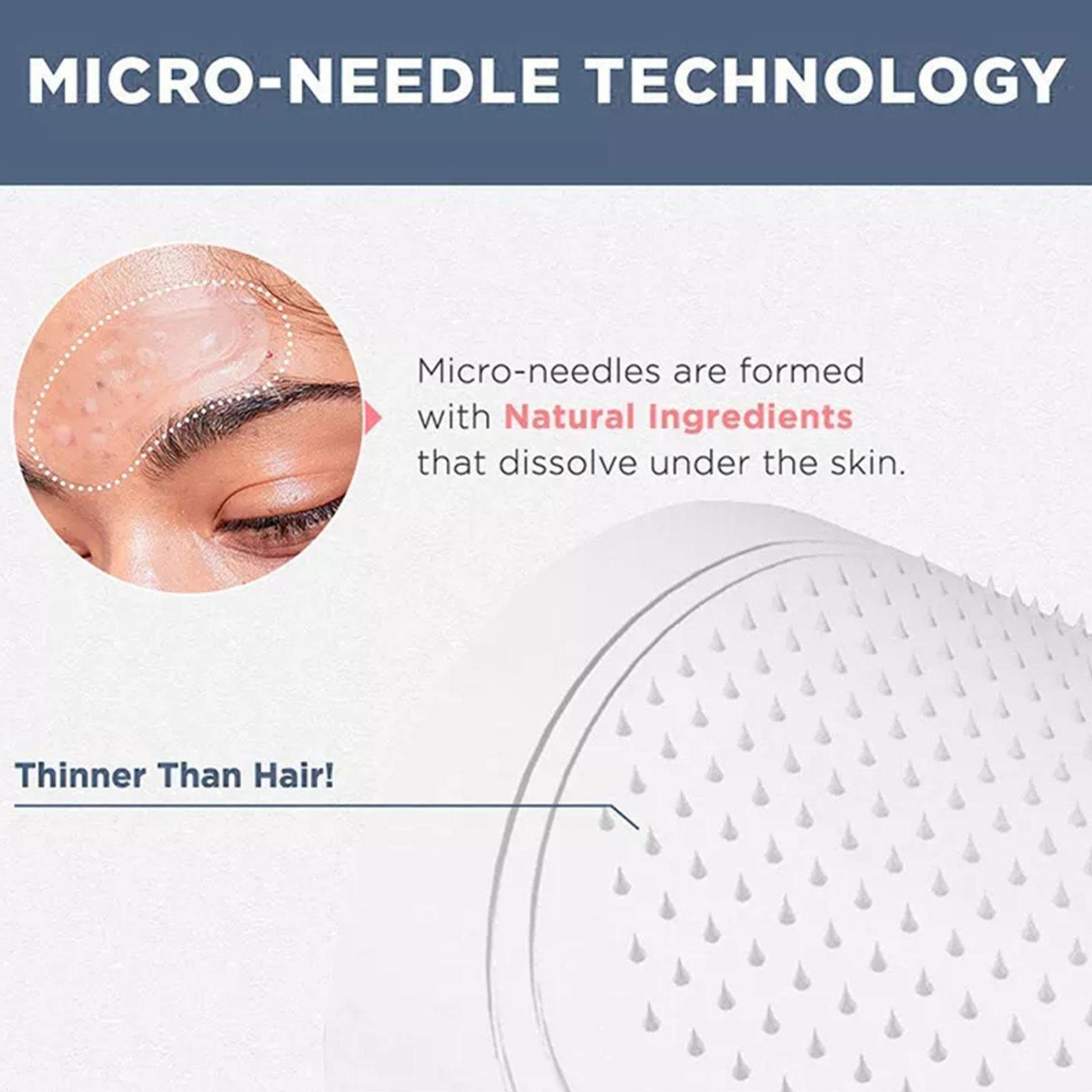 0,2mm Mikronadel-Augenmaske mi – Microneedle Patch Eye Bewertung und Preis